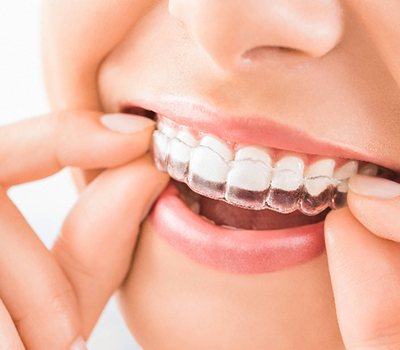 Specialized Orthodontist in Doha
